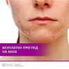 Безплатни прегледи и консултация  за акне в клиника REVERSE на 05.03.17г.